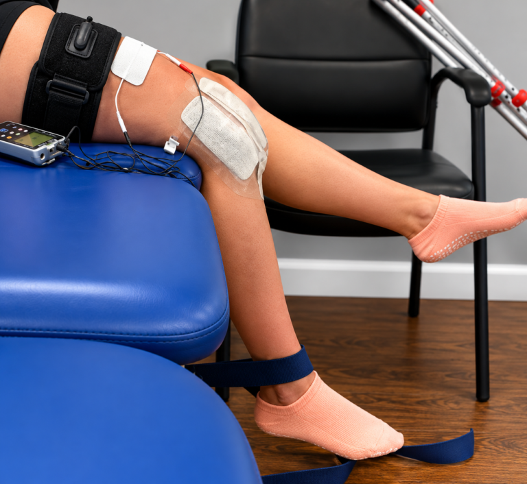 When Should Physical Therapy Start After ACL Reconstruction?